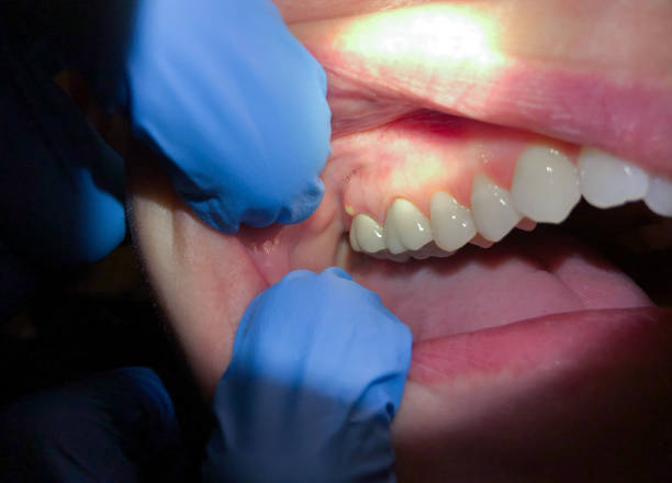 Best After-Hours Emergency Dentist in East Lexington, VA
